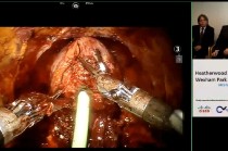 HD imagery of prostatectomy with NHS, VideoCentric and Cisco slide on right.