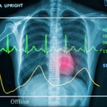 X-ray and EKG line overlaid. Image courtesy of Praisaeng at freedigitalphotos.net